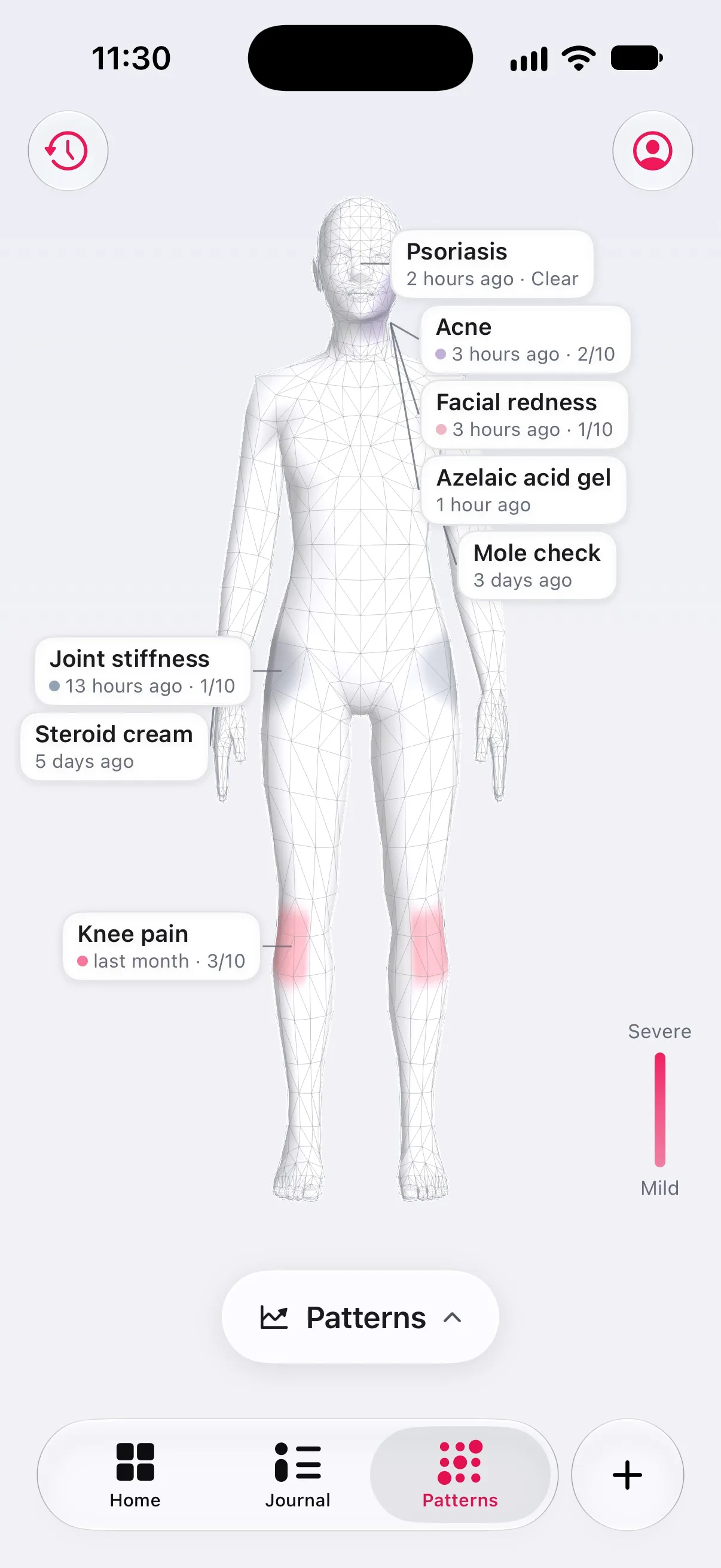Longnote’s body atlas: a 3-D figure with both shoulders, the hips and both knees tinted, and callouts for shoulder pain, psoriasis, joint stiffness and knee pain, beside a mild-to-severe scale.