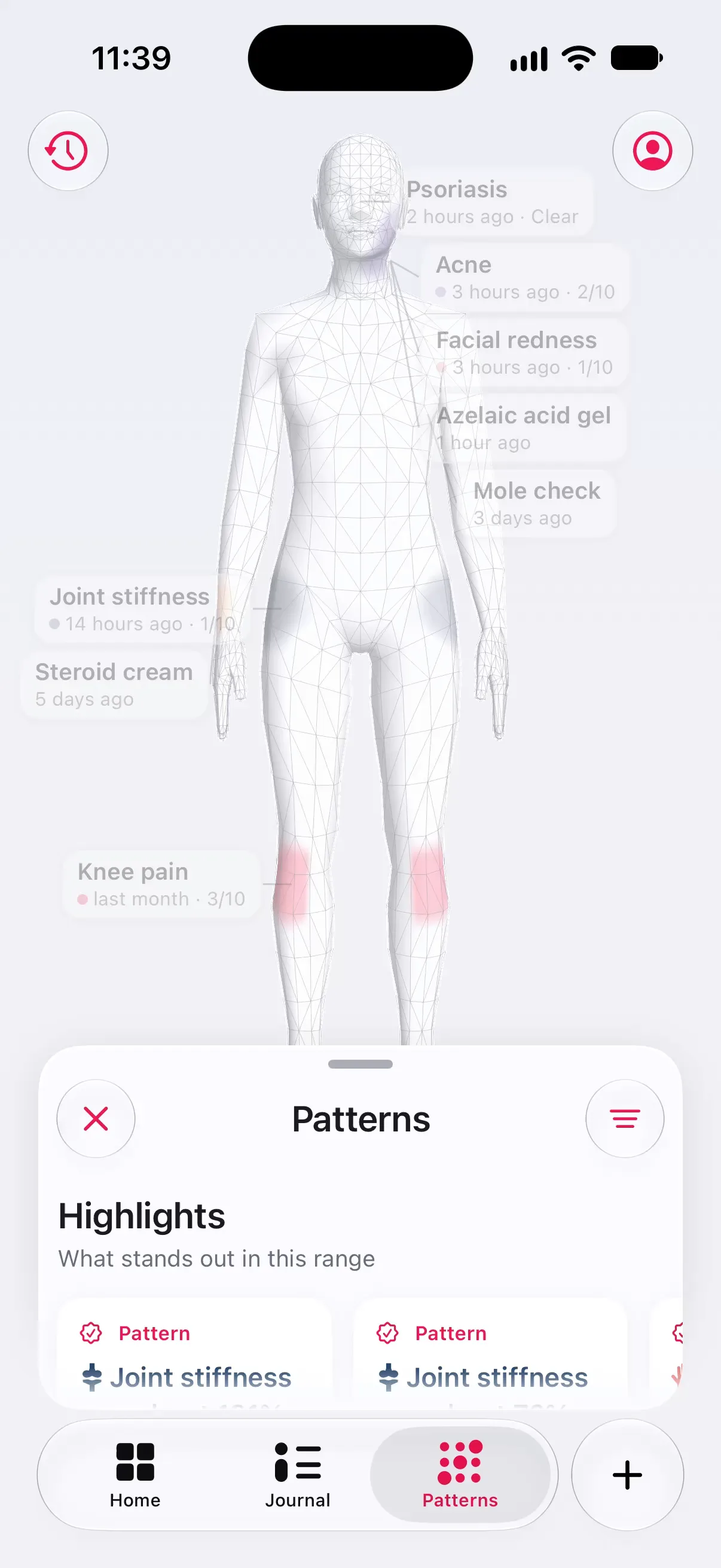 Longnote’s Patterns tab: the body with tinted shoulders, hips and knees and dated callouts, a mild-to-severe scale, and a Patterns pill at the bottom that opens the Highlights drawer.