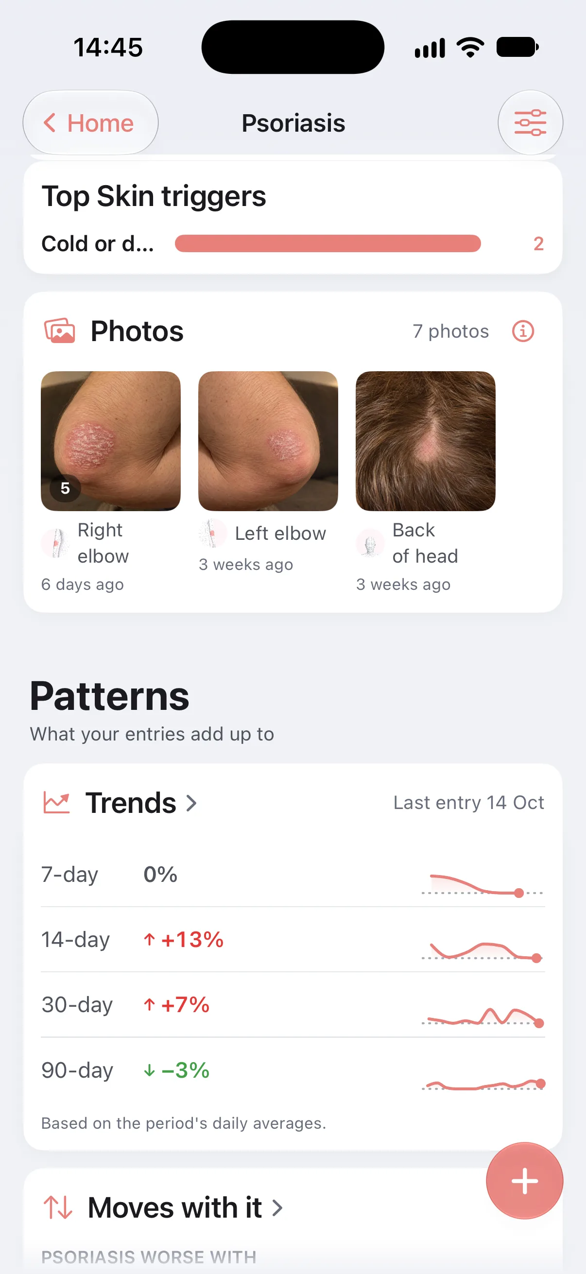 The Photos card in Longnote’s overview of a psoriasis tracker: 7 photos, in albums for the right elbow, with 5 photos and the newest from 6 days ago, the left elbow and the back of the head, each from 3 weeks ago.
